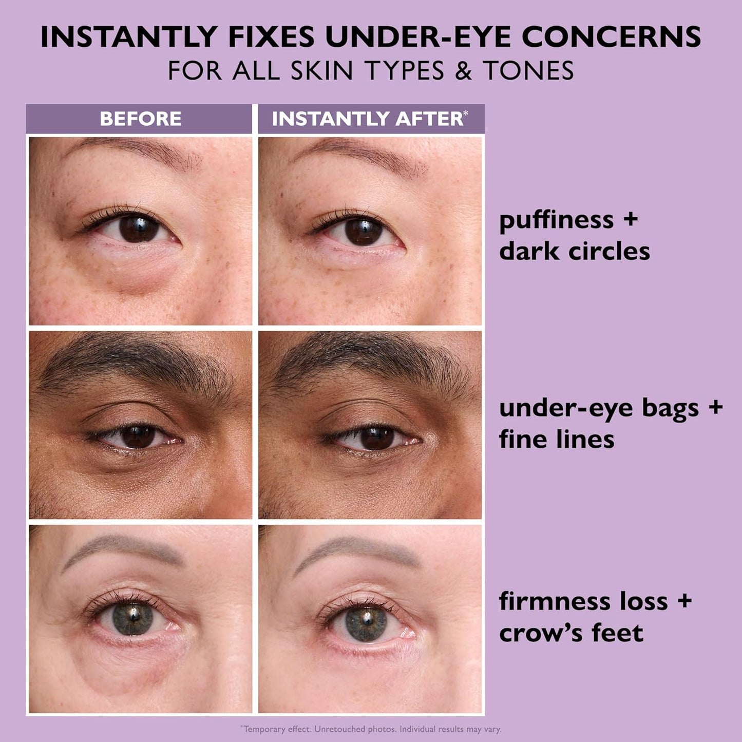 Peter Thomas Roth | Instant FIRMx® Eye Temporary Eye Tightener Easy-Wear Formula