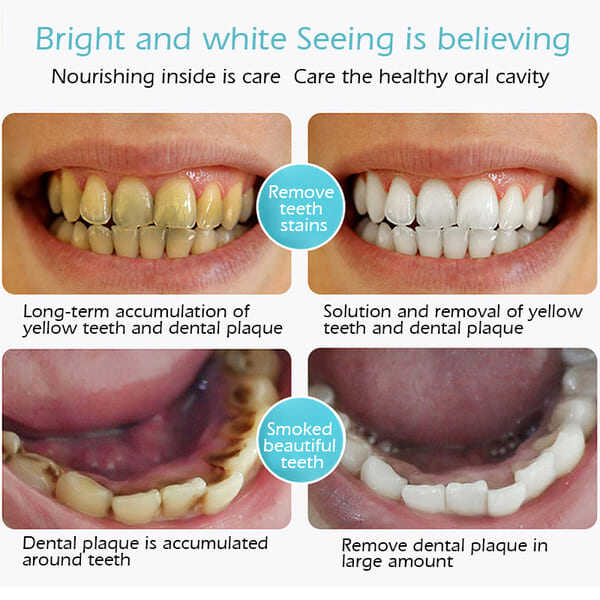 🔥2025 Best Seller🔥Mousse Foam Whitening Toothpaste