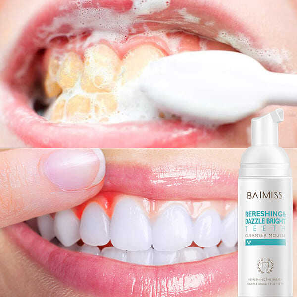 🔥2025 Best Seller🔥Mousse Foam Whitening Toothpaste