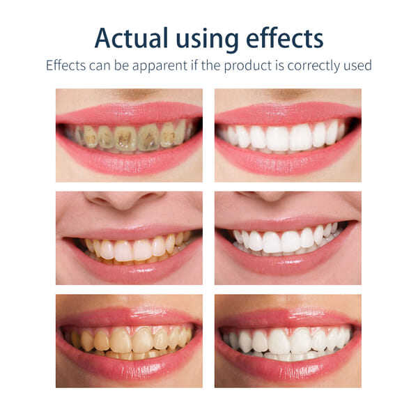 🔥2025 Best Seller🔥Mousse Foam Whitening Toothpaste