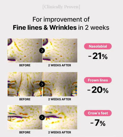 The Peptide Collagen Hydrogel Eye Patch✨DEPUFFS UNDERYE BAGS IN JUST 10 MINUTES