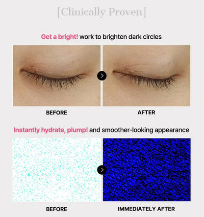The Peptide Collagen Hydrogel Eye Patch✨DEPUFFS UNDERYE BAGS IN JUST 10 MINUTES